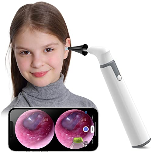 ScopeAround Wireless Otoscope Ear Camera