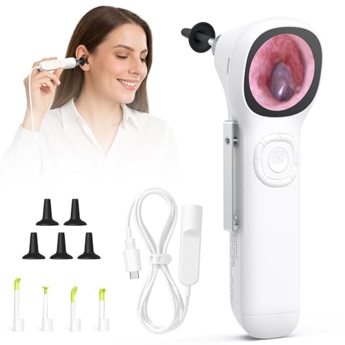 ScopeAround Digital Otoscope with Light